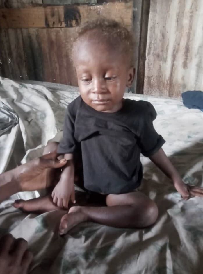 Charles before treatment